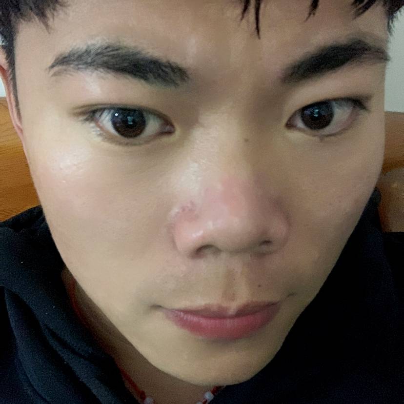 小甜瓜迎潇洒的照片