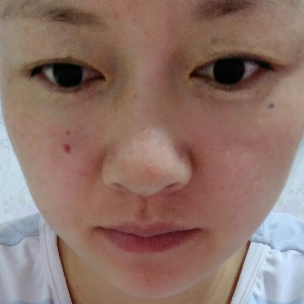 杨梅果干的照片