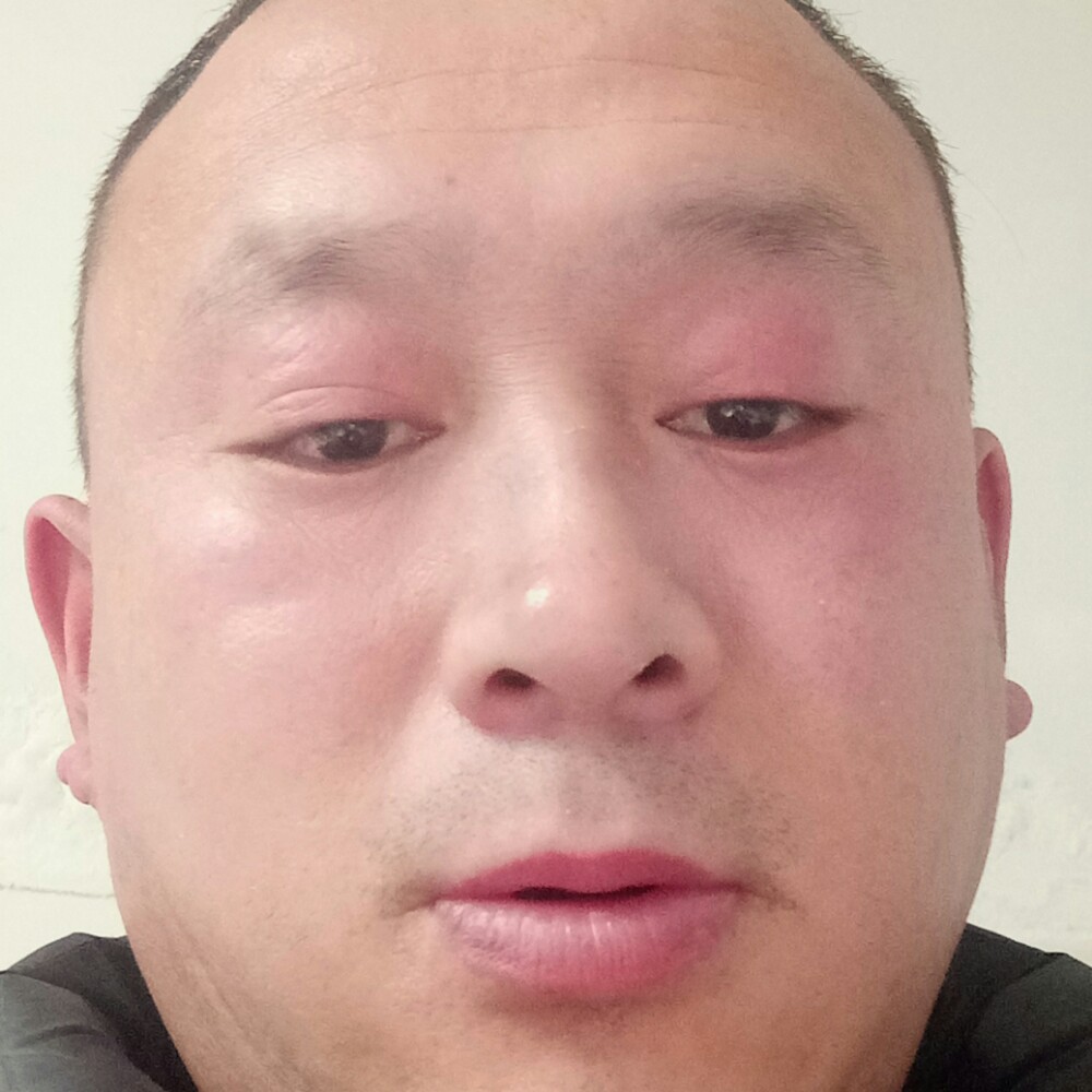 激动那香菇的照片