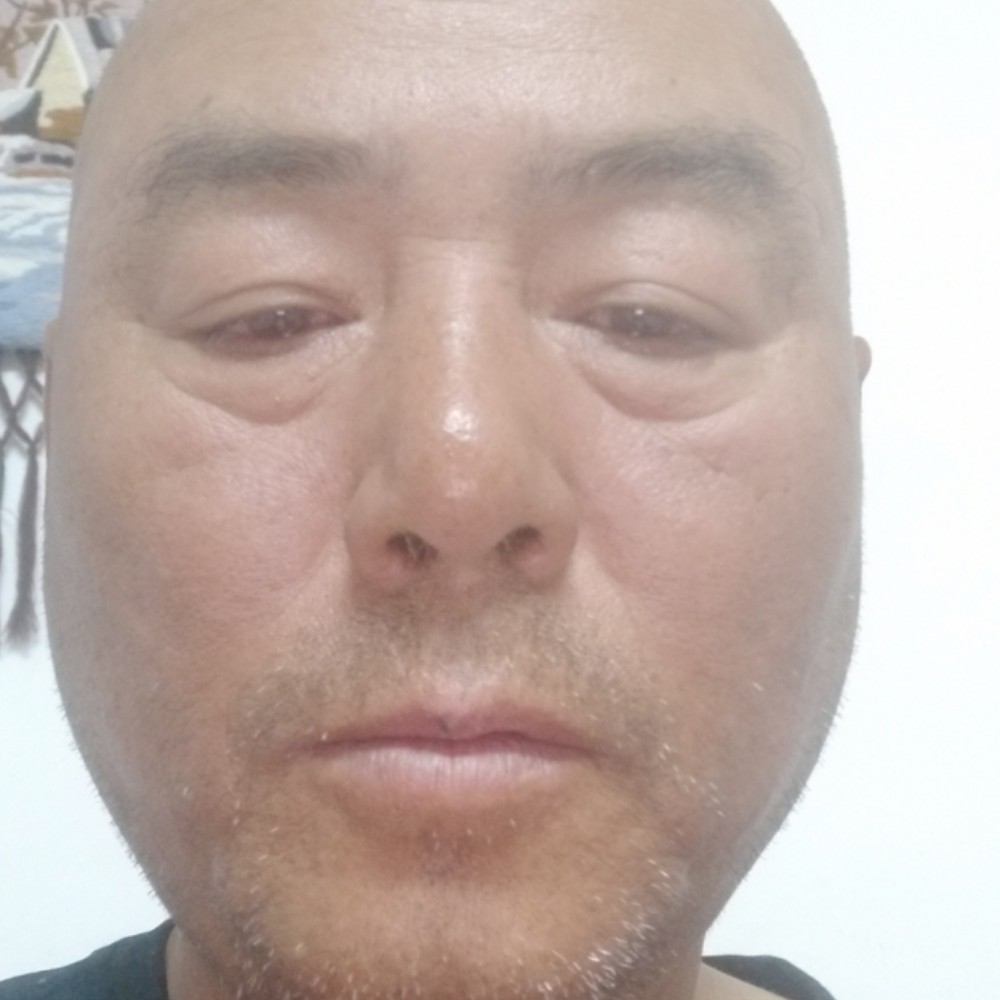 芒果喜悦杲龙的照片