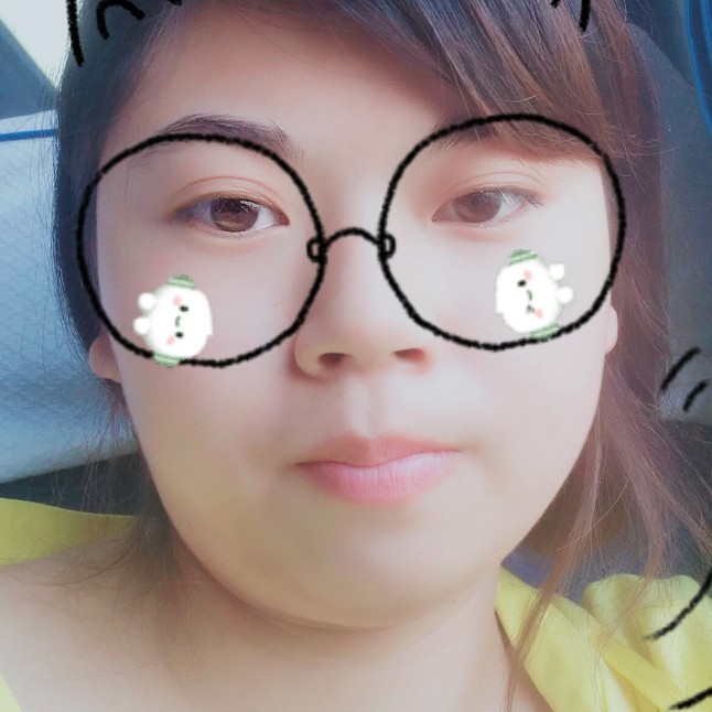 戒指蹙眉受伤的照片