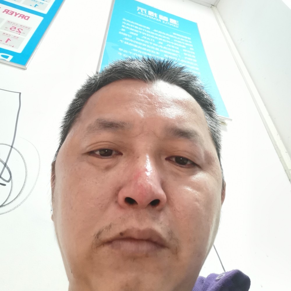 斑马碧蓝的照片