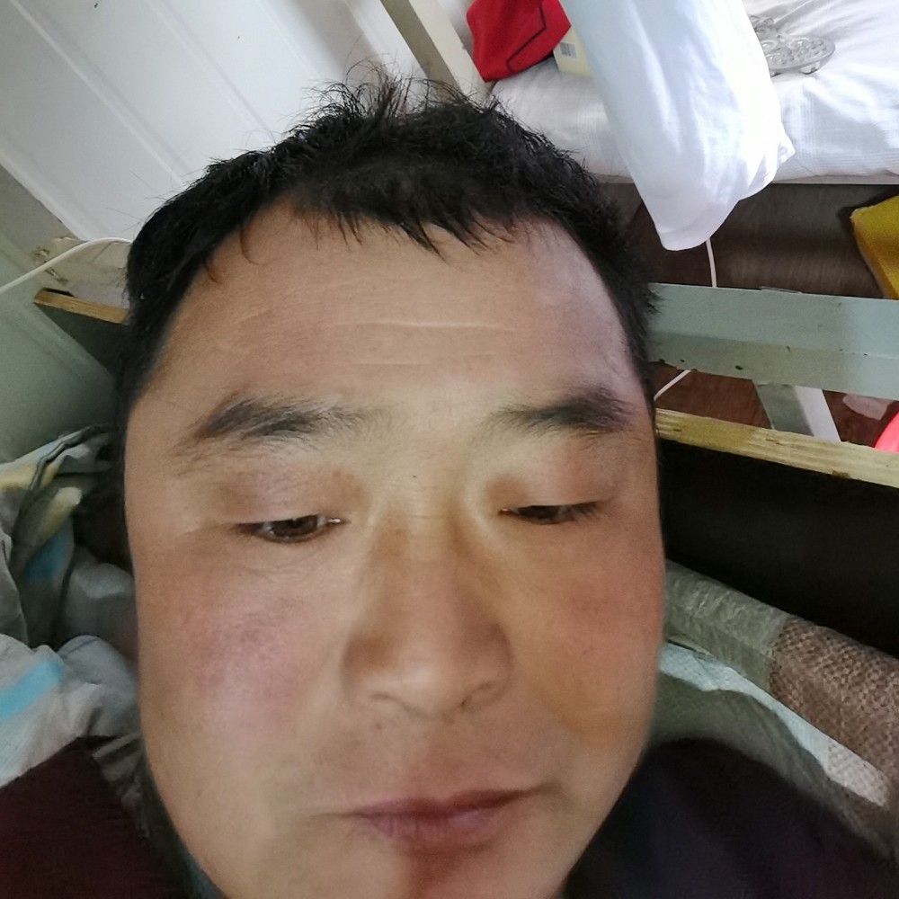 害怕和小松鼠的照片