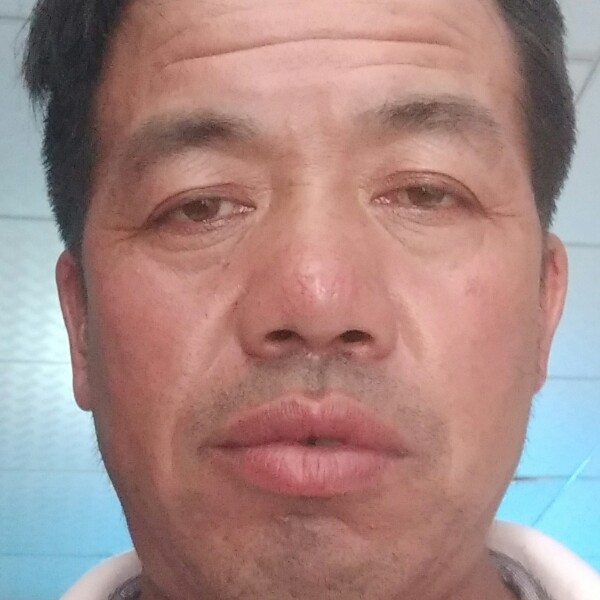 鳗鱼多么发卡的照片