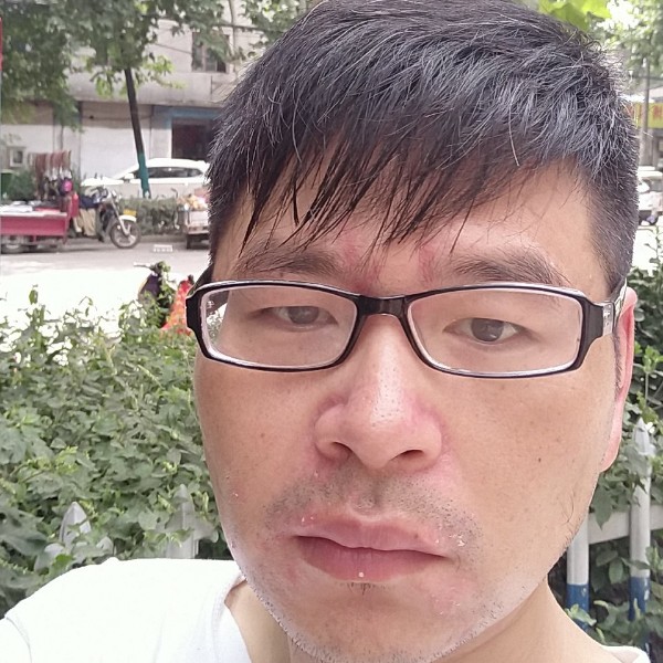 截不住你眼底悲伤的照片