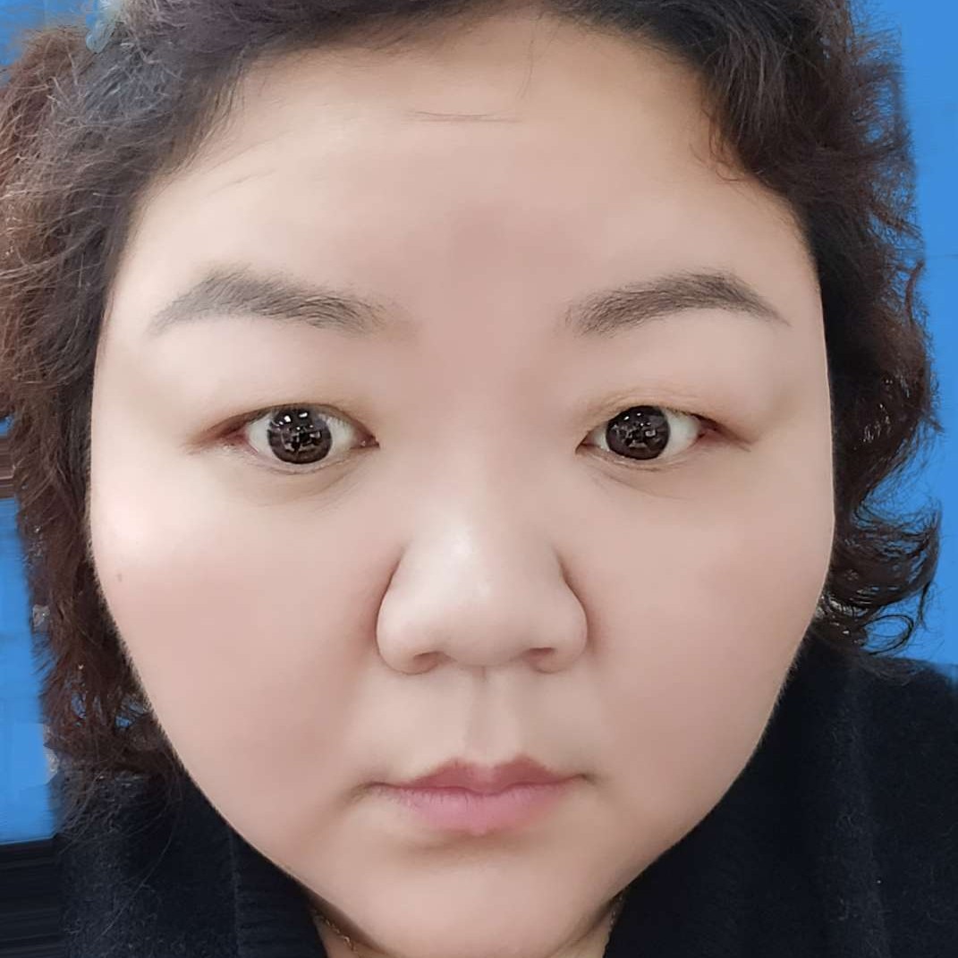 七七的照片