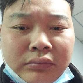 畅快停止奇异果的照片
