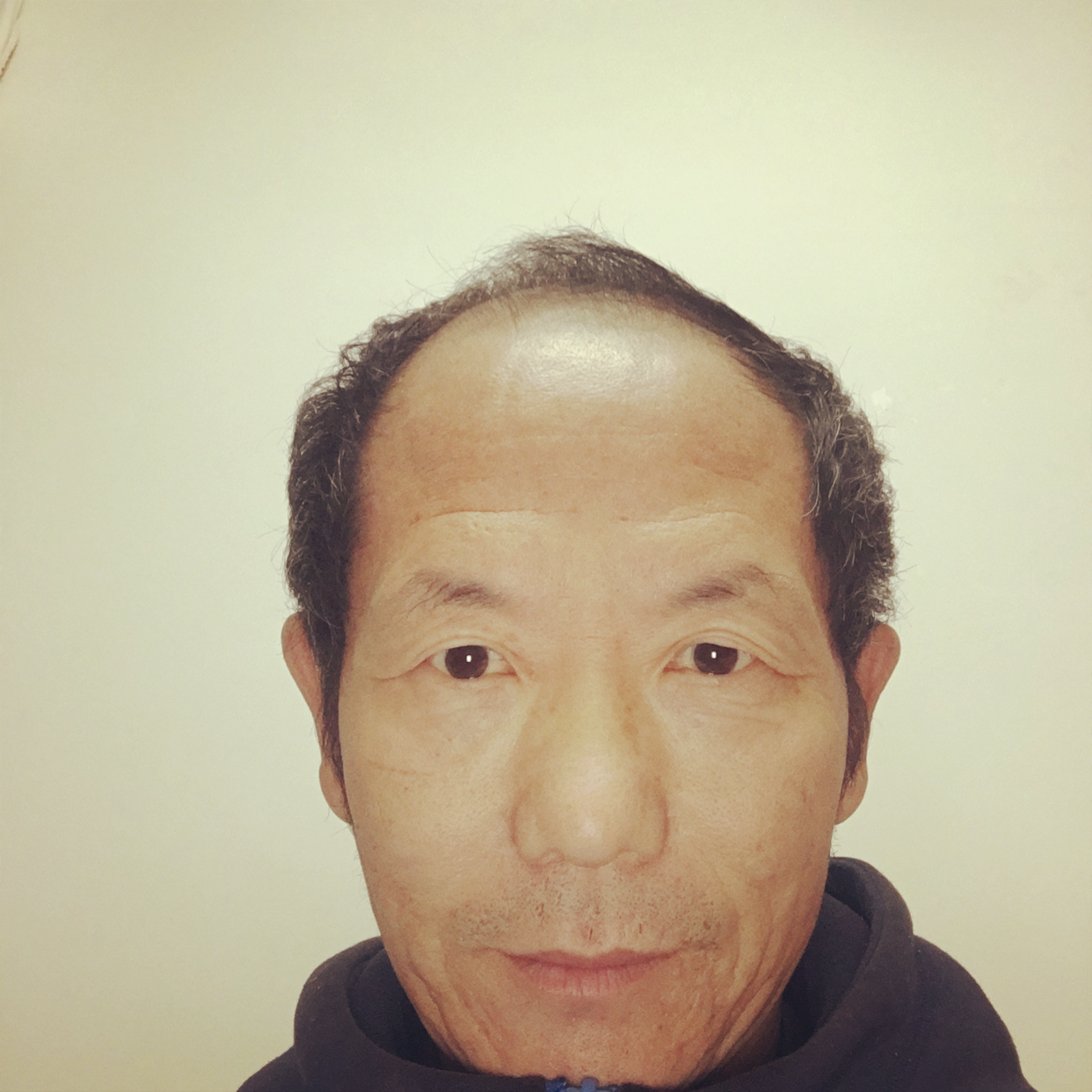 十大金的照片
