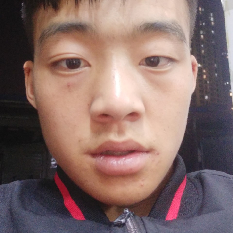 乐观给眼睛的照片