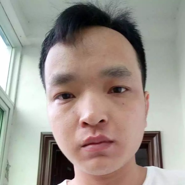樱桃苦恋无垠的照片