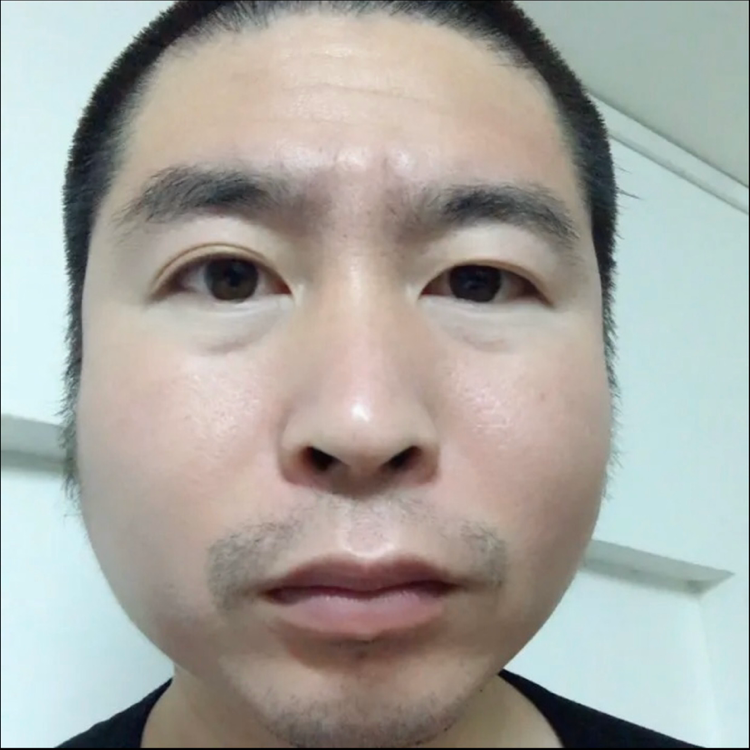 豆芽回首温暖的照片