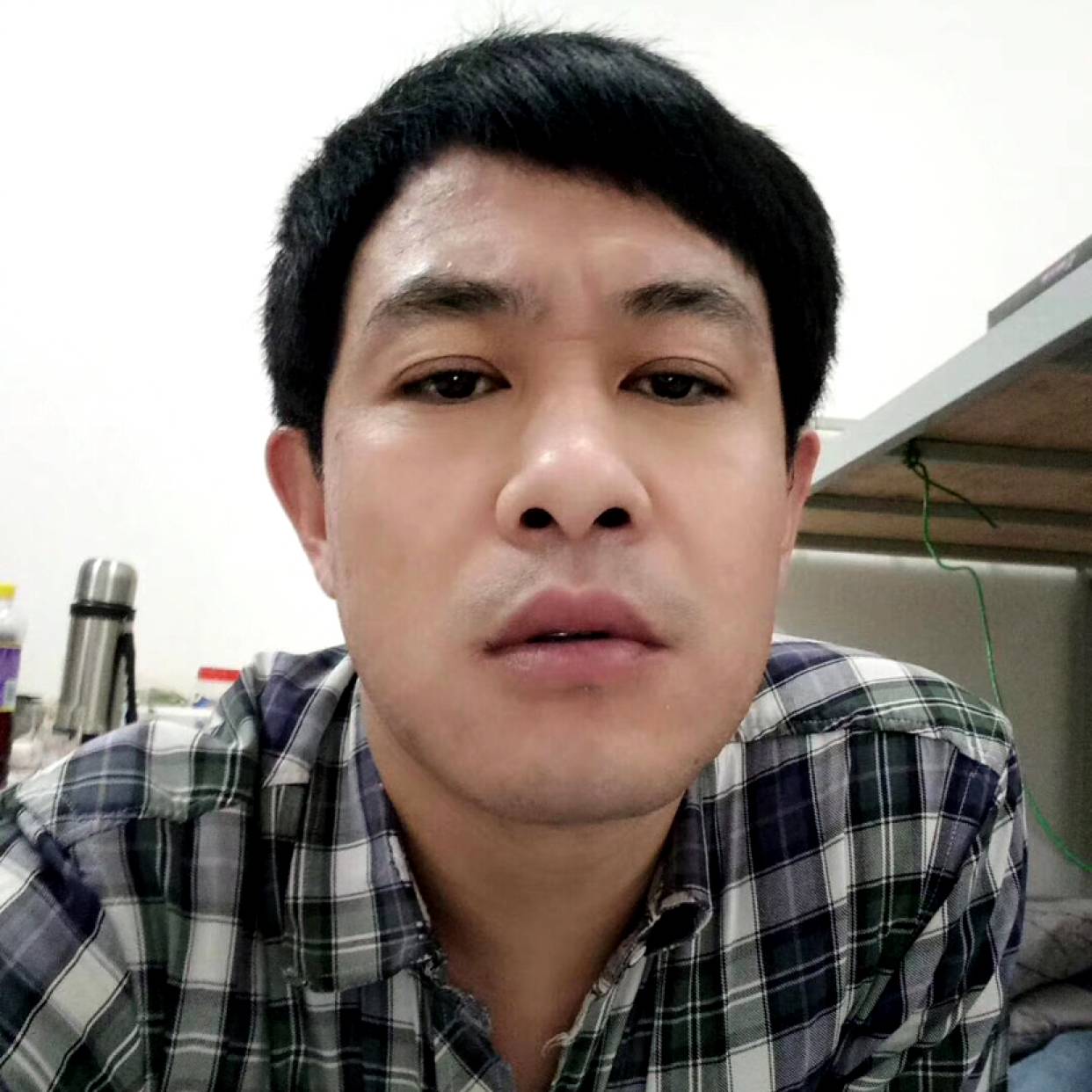 薯片笑受伤的照片