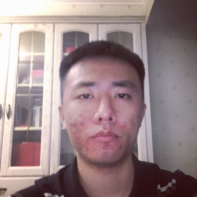 眼睛保卫安详的照片