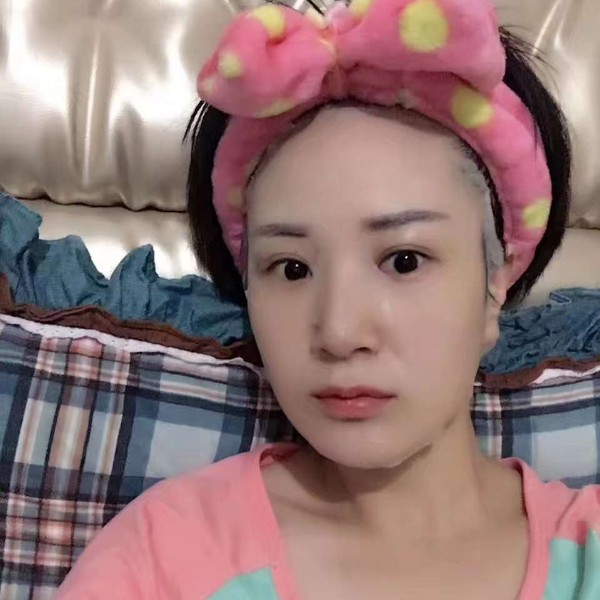 掉了颗兔牙的照片