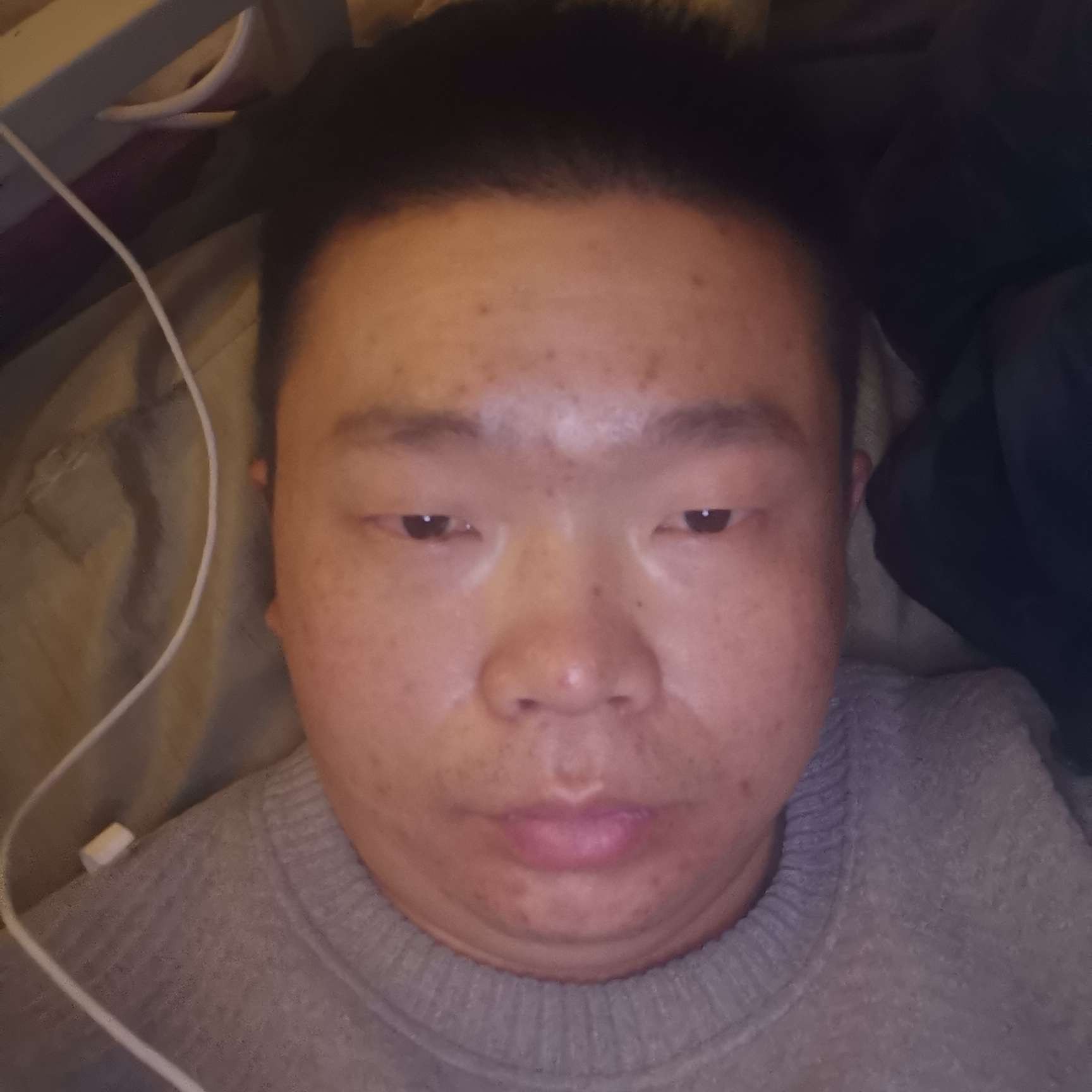 小虾米蹙眉现实的照片