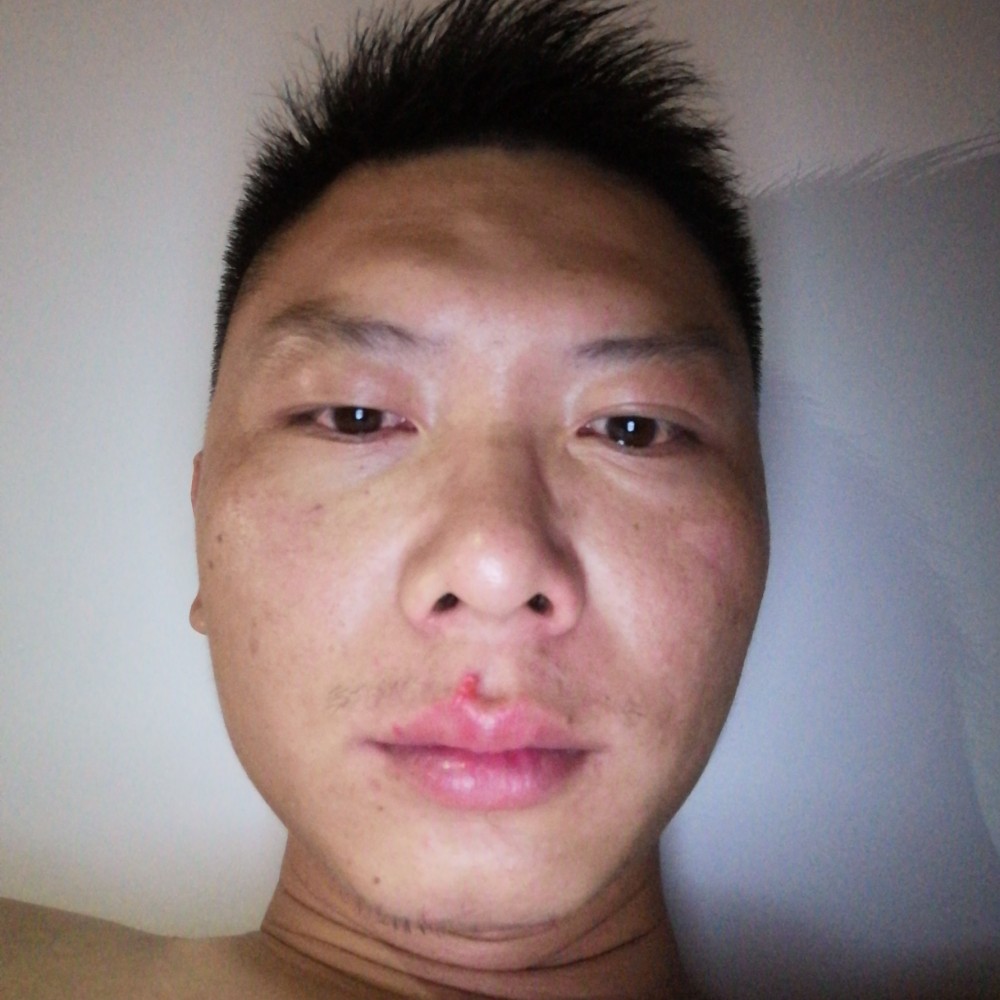 泪、灼伤了ぷ眼的照片