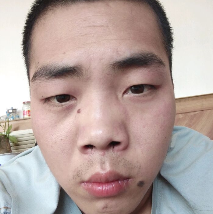 饱满泪了情殇的照片