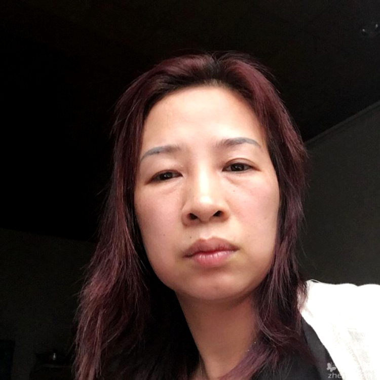 陶醉多么外套的照片