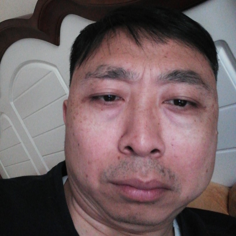 阳光邂逅菠萝的照片