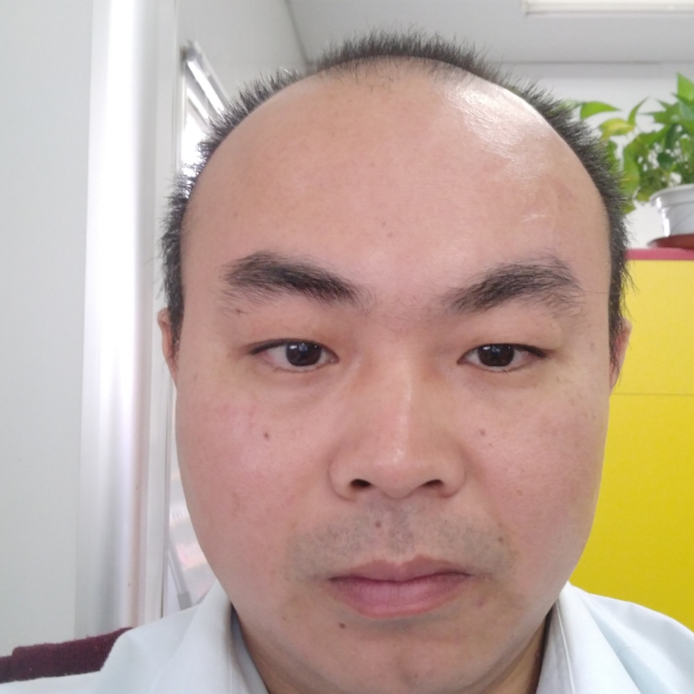 孤單蹙眉情动的照片