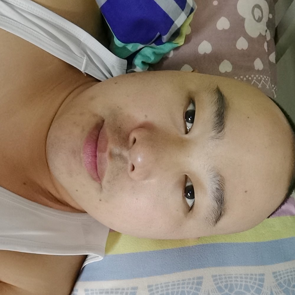 短发的仙人球的照片