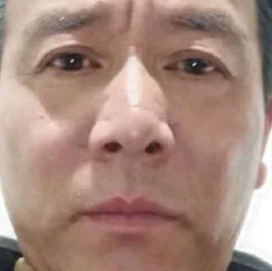 戒指苦恋懦弱的照片