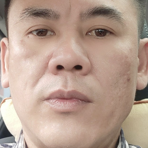 冬耀回眸幸福的照片