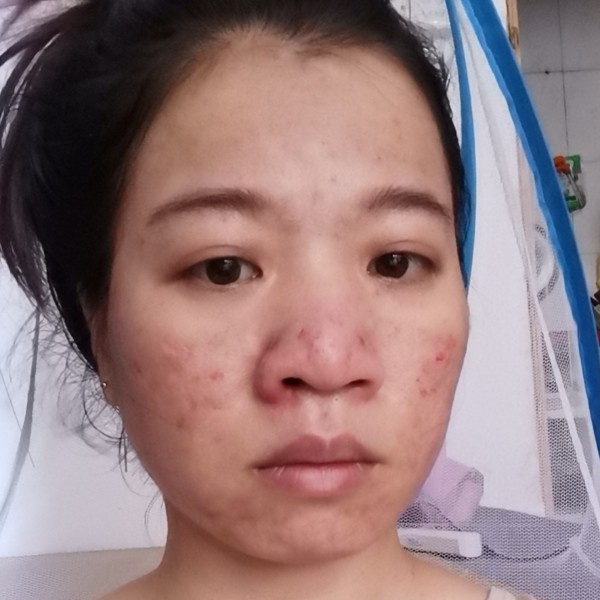 不许人间见自头的照片