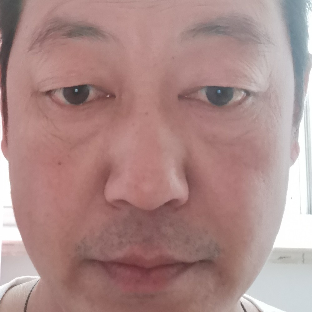 黑麦哥的照片