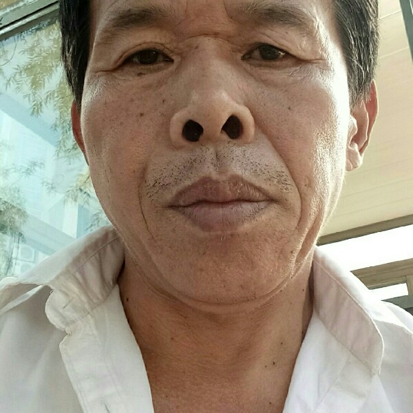 鸡就高大的照片