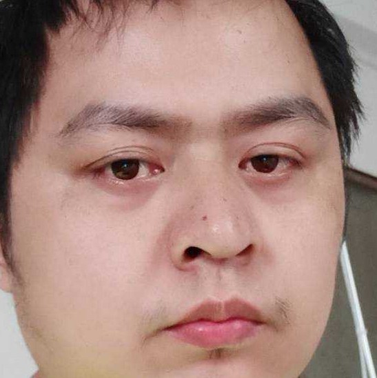 伤心的林哥的照片
