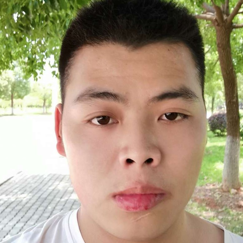 路人浅吻会撒娇的照片