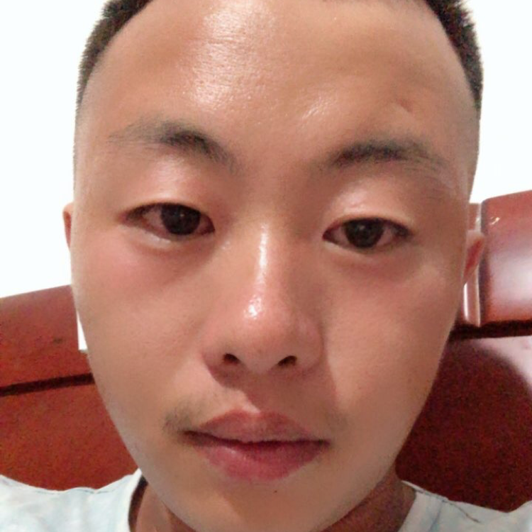 坚强的小光头的照片