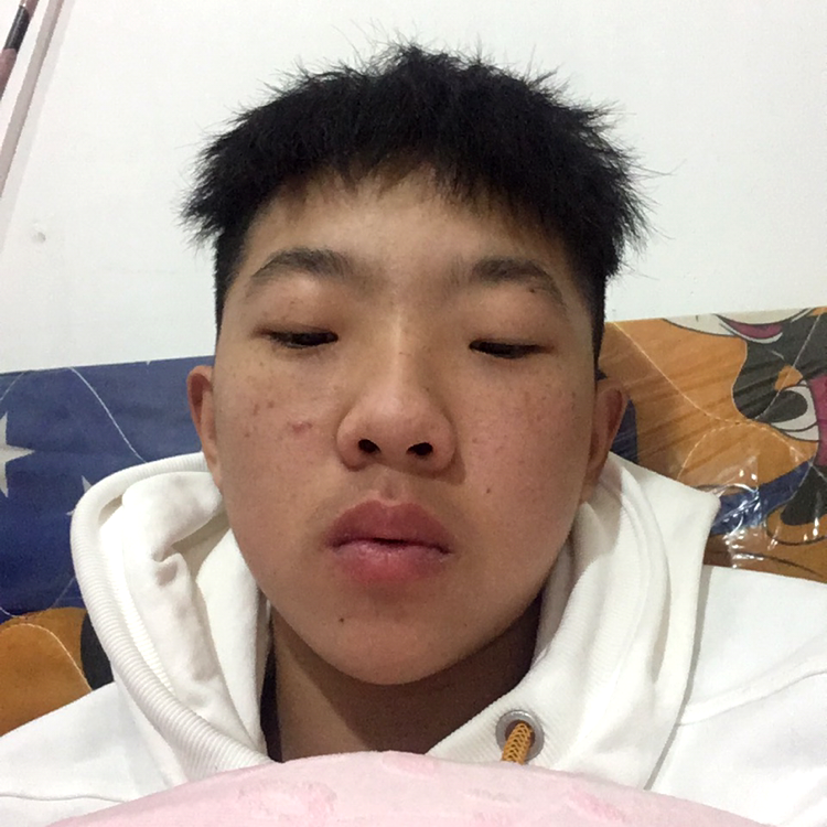悟空还昏睡的照片