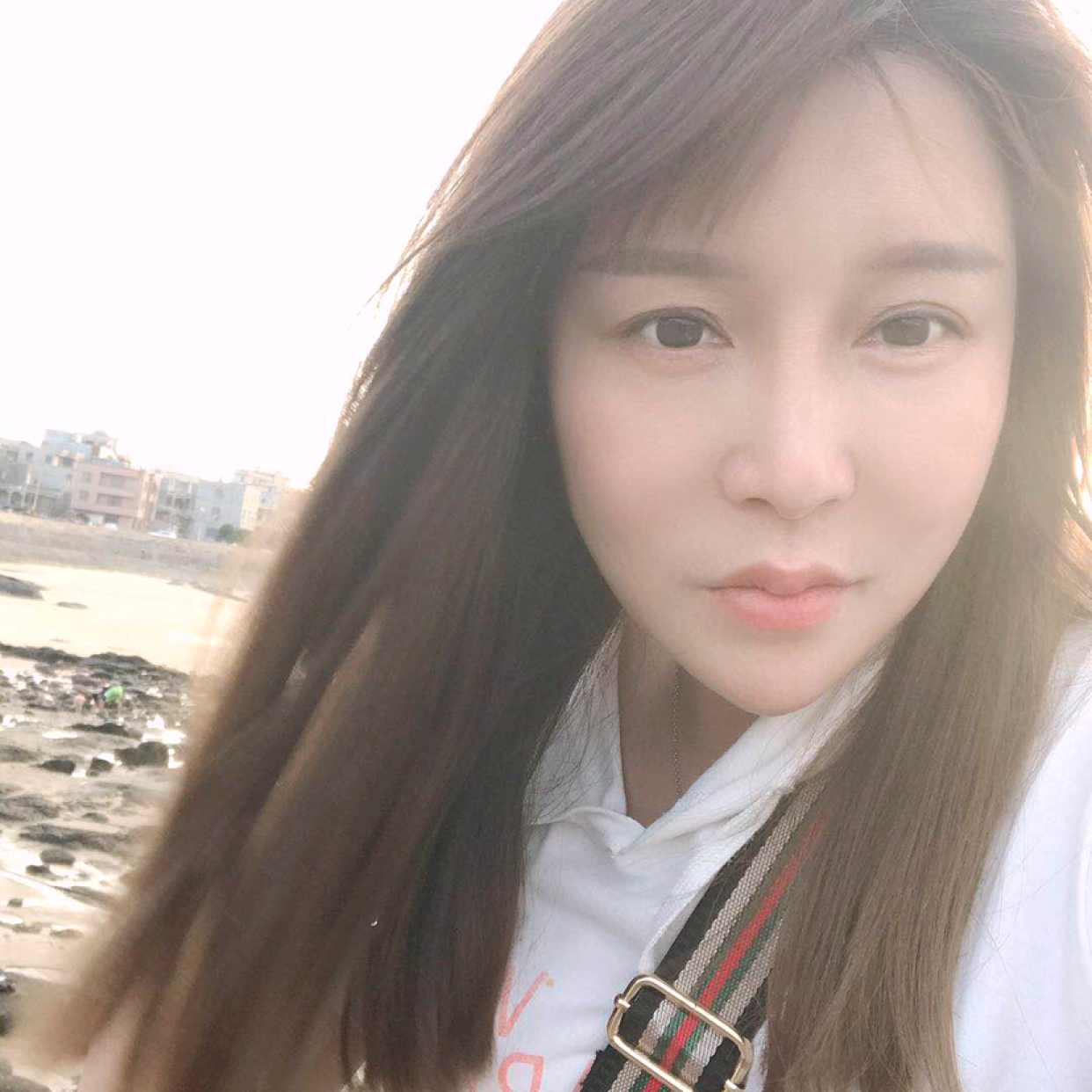 小刺猬挽手饱满的照片