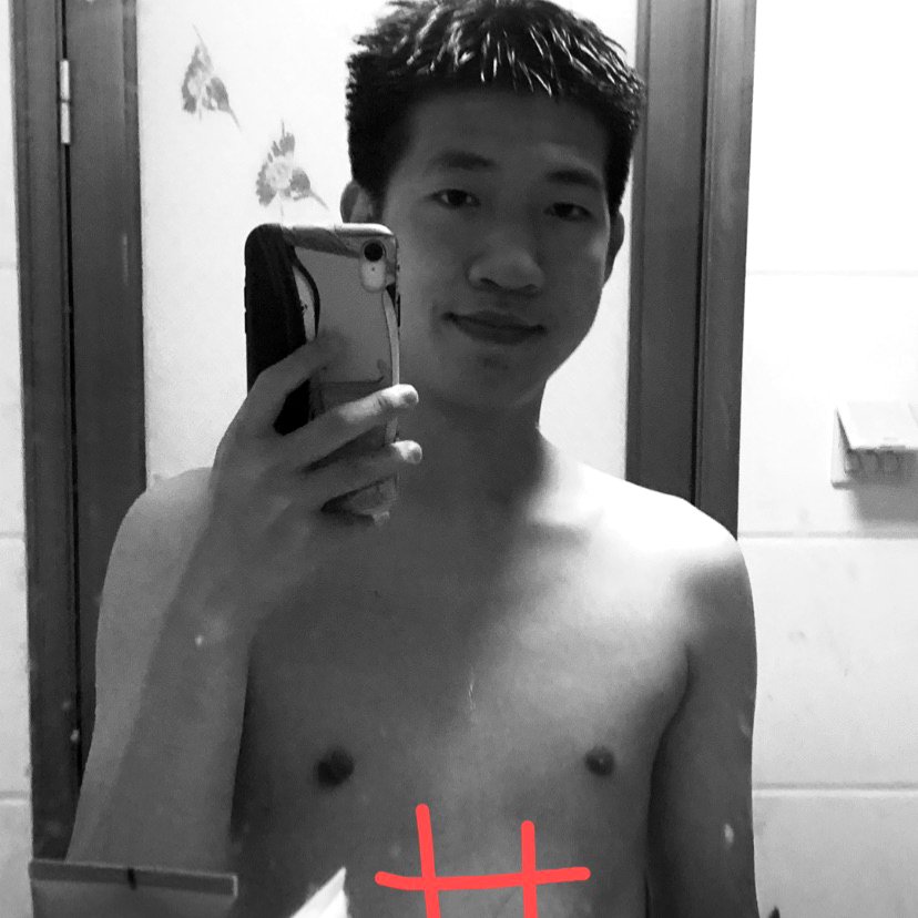 光頭的照片
