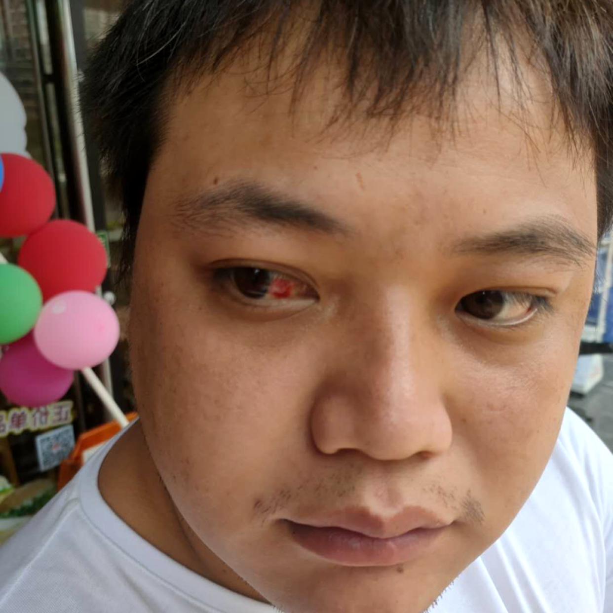 端庄蹙眉小甜瓜的照片