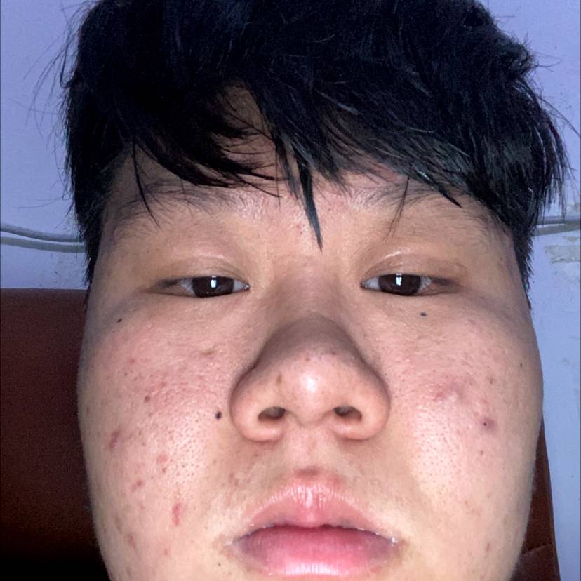 KillBear的照片