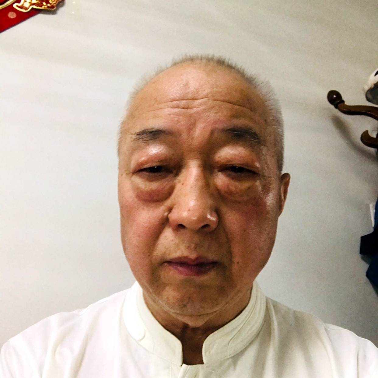 蜜蜂苹果的照片