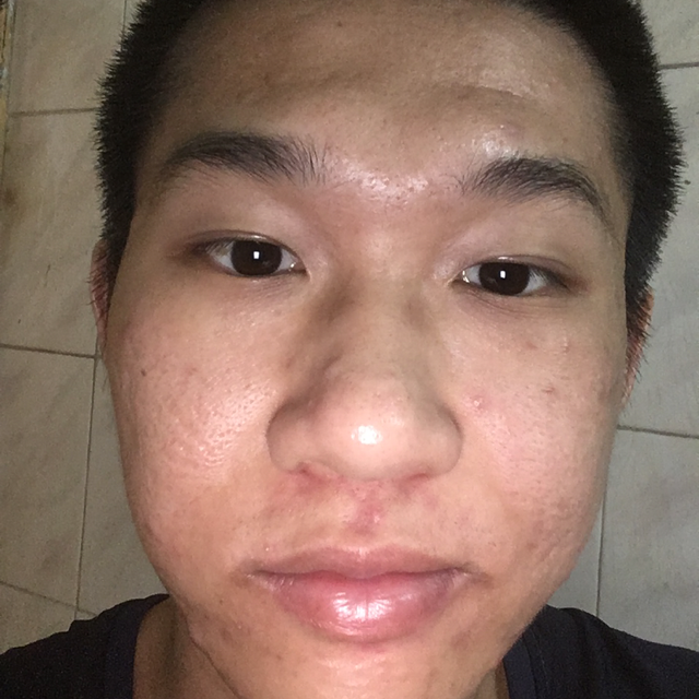 阿新是我的照片