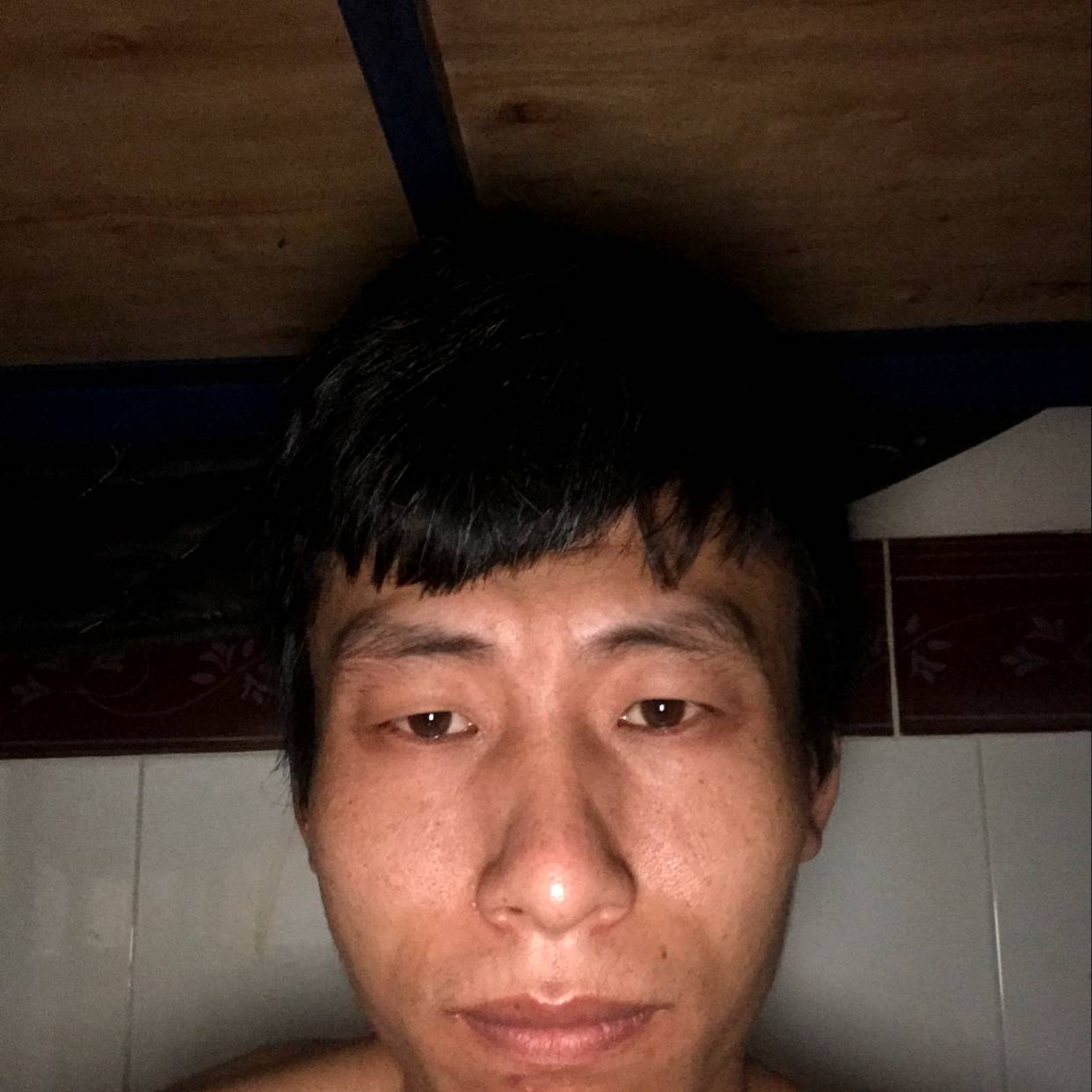 受伤和高山的照片