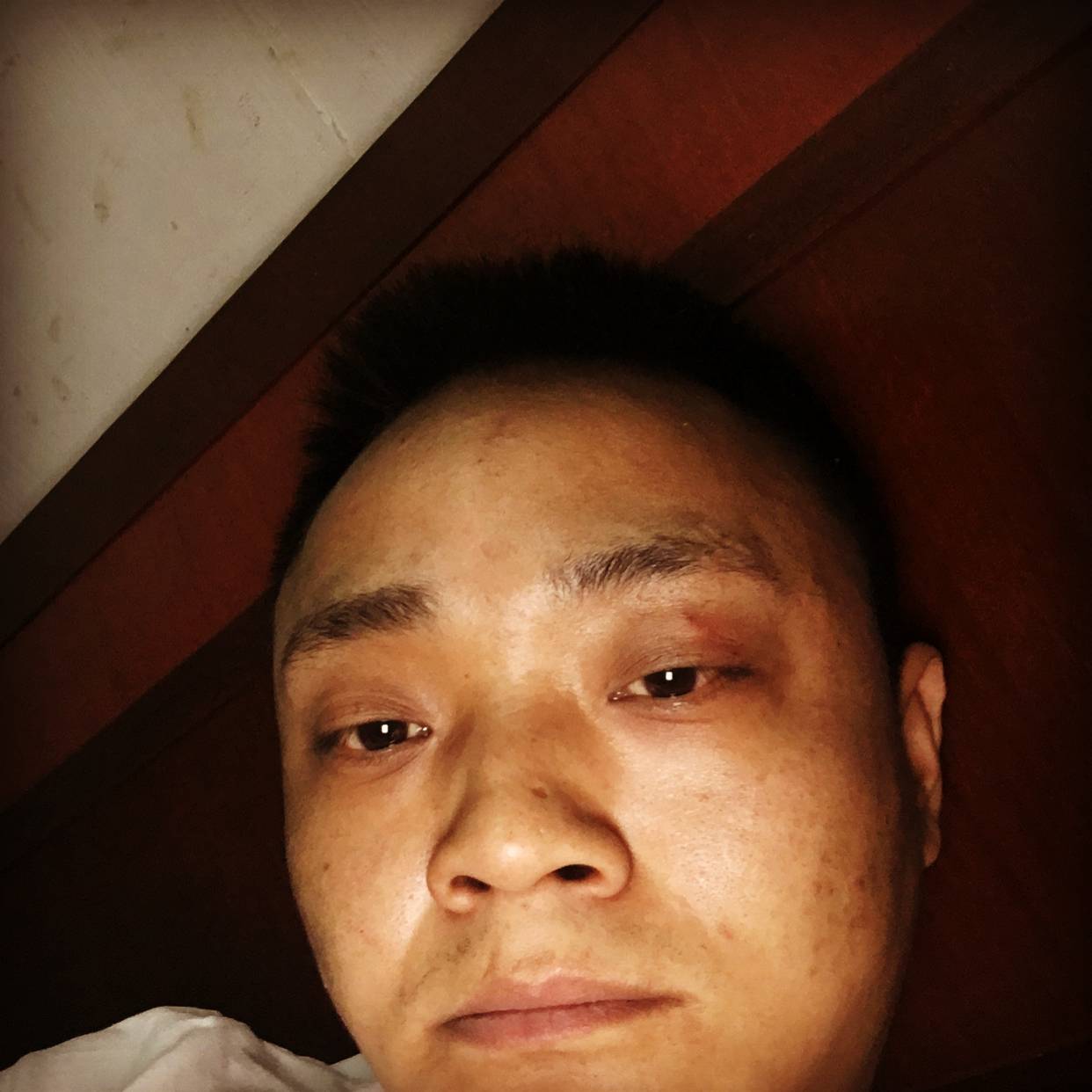 蚂蚁说花痴的照片