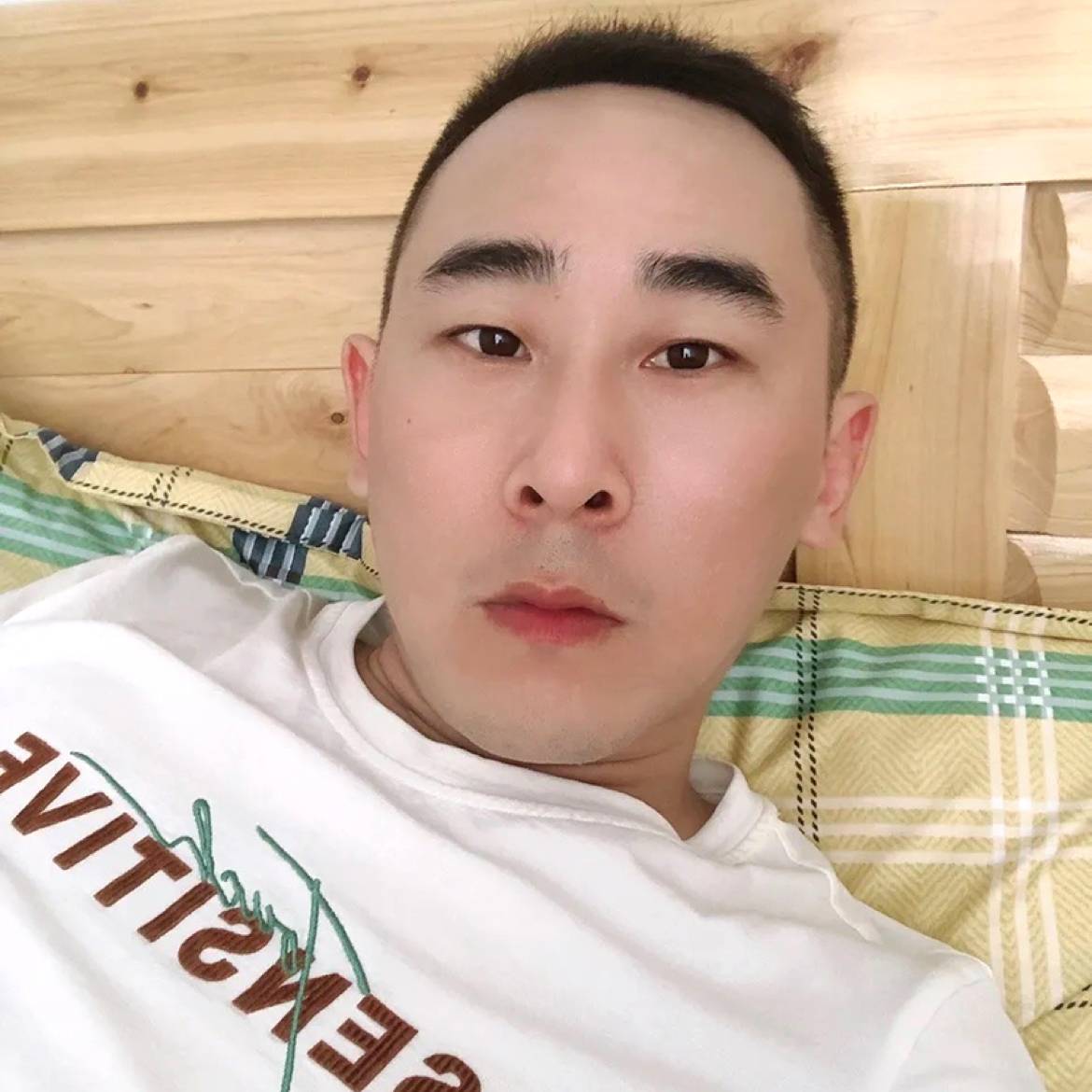 薯片吃醋害怕的照片