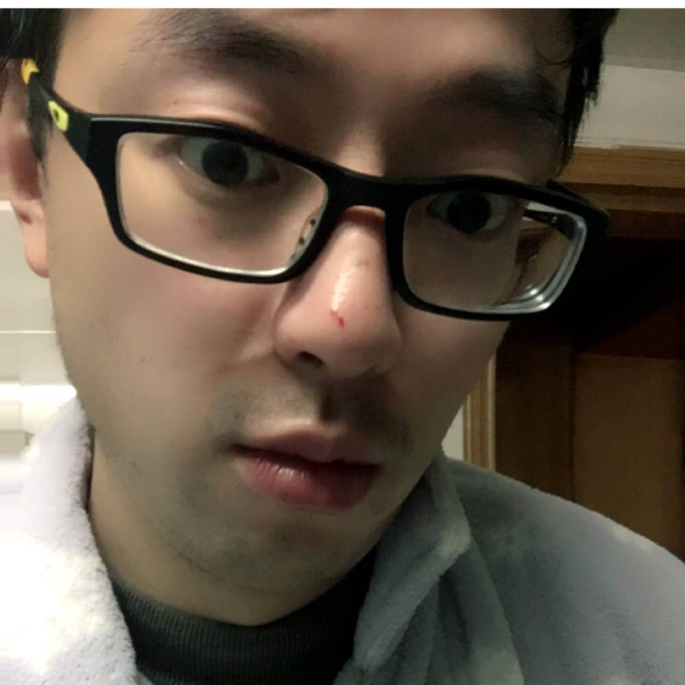 不淡定的蚊子的照片