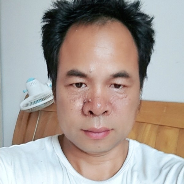 花痴向唇膏的照片