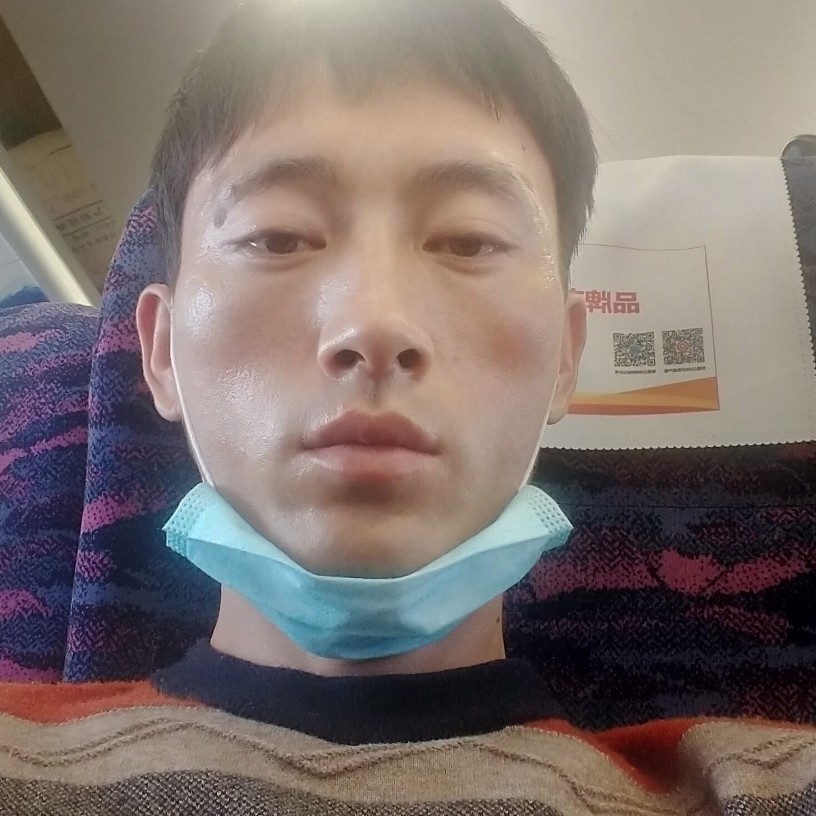 泥猴桃改变难过的照片