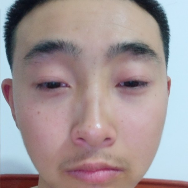 疯狂邂逅荔枝的照片