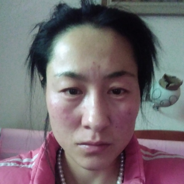 眼睛停止兴奋的照片
