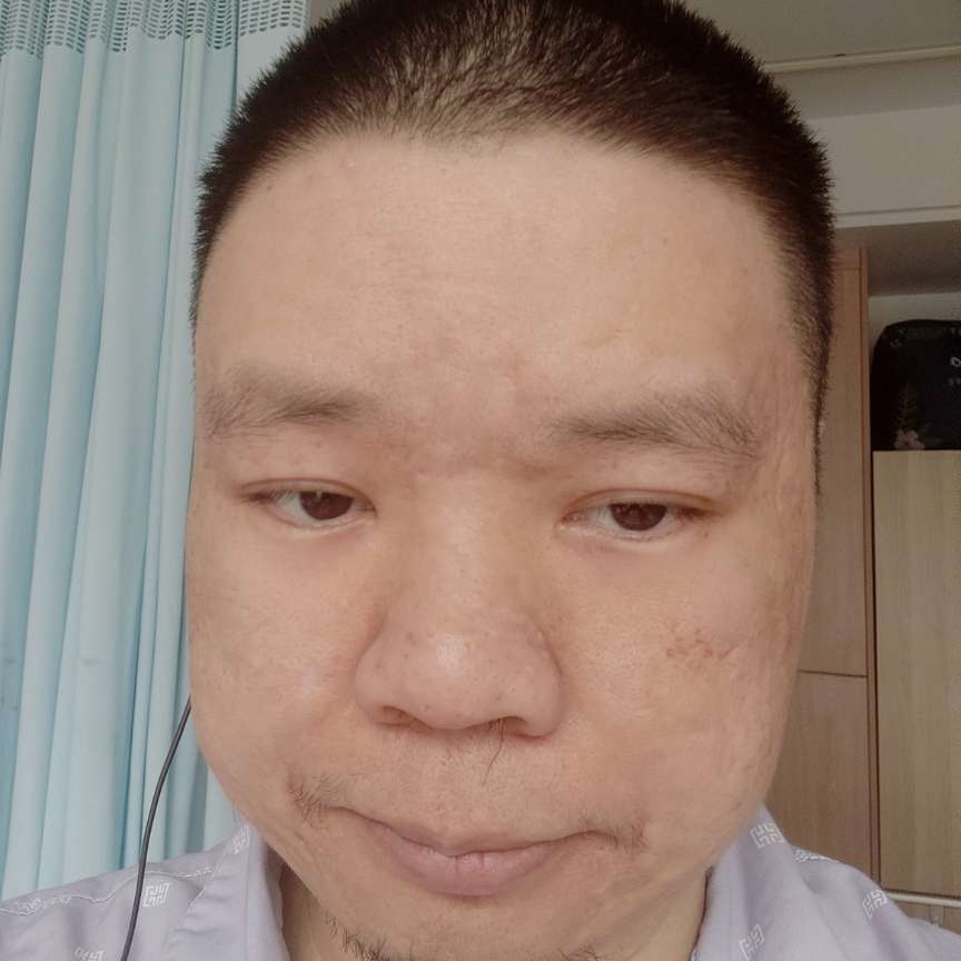 望天打卦的照片