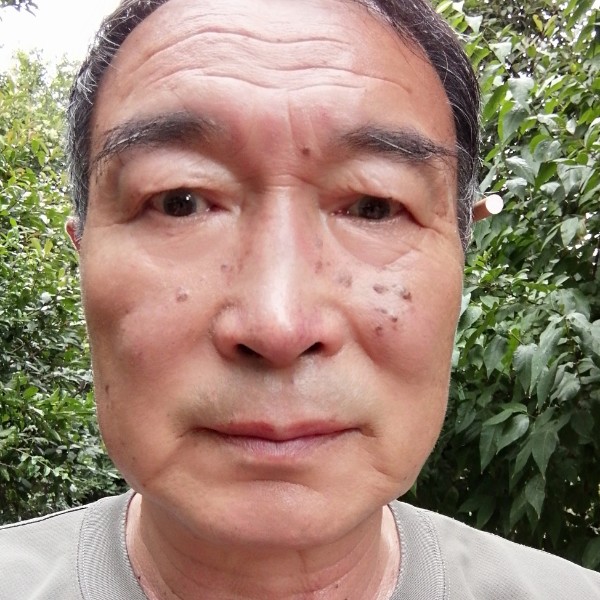 毛巾忧心的照片